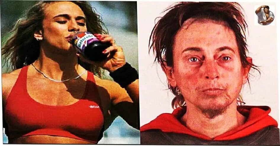 Девушки до и после стероидов. Женщины после стероидов. Спортсмены использовавшие допинг