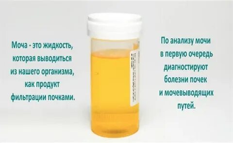 По моче можно болезнь