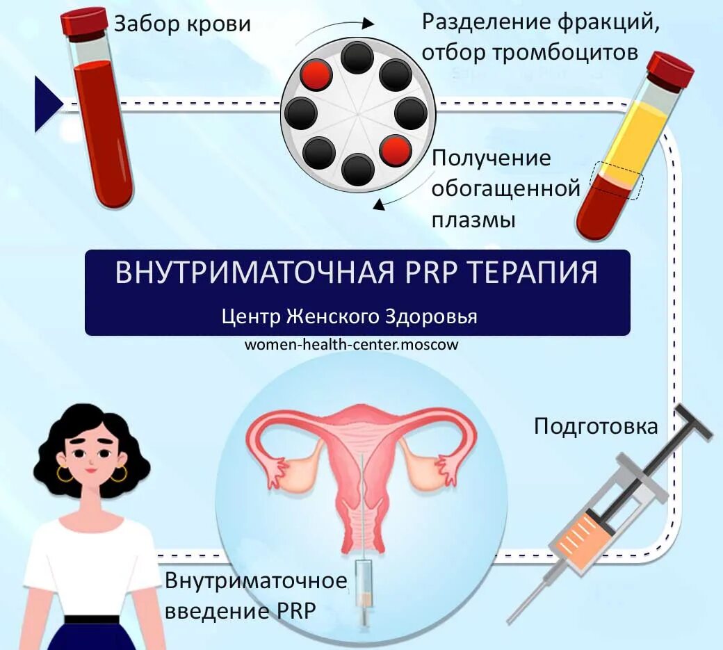 Плазмотерапия в гинекологии. Плазма терапия в гинекологии. PRP терапия в гинекологии. Плазмотерапия PRP. Prp эндометрия