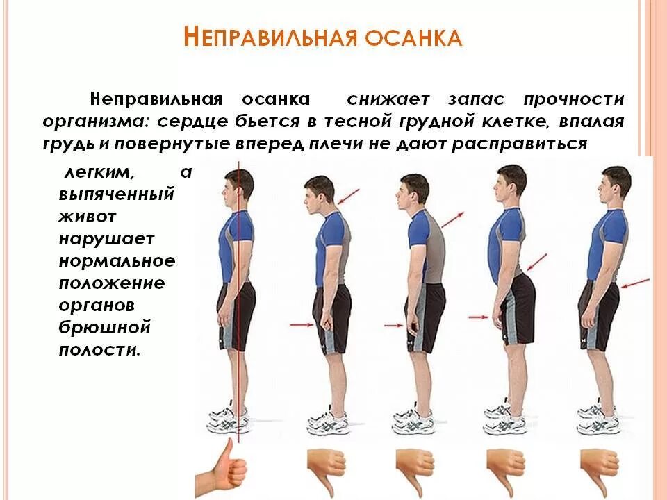 Правильная поясница. Человек с правильной осанкой сбоку. Правильное положение позвоночника сбоку. Правильная осанка. Неправильная осанка.