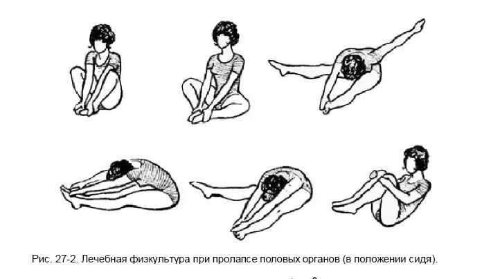 Опущение женских половых. Опущение матки лечебная физкультура. Гимнастика для матки при опущении матки. Лечебная гимнастика по Атабекову при опущении органов малого таза. Гимнастика кегеля для женщин при опущении органов малого таза.