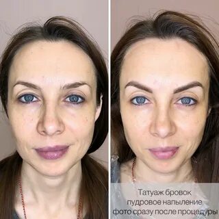 Нужна ли коррекция