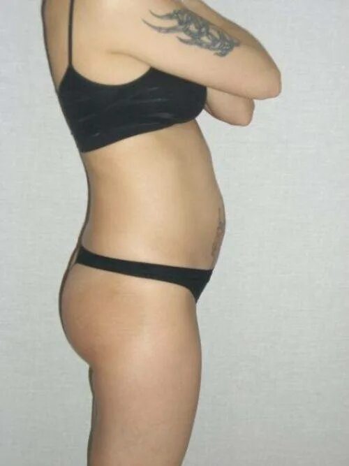 18 недель слабость. Живот на 18 неделе беременности. Живот на 18 акушерской неделе. Живот у беременных на 18 неделе.