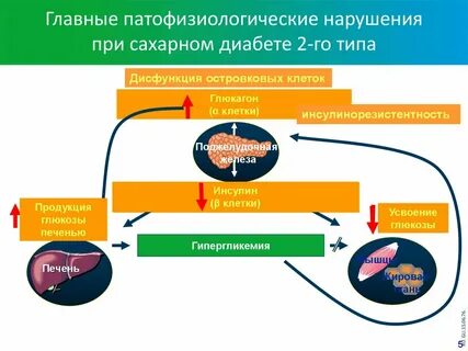 Сахарный диабет 1 2021