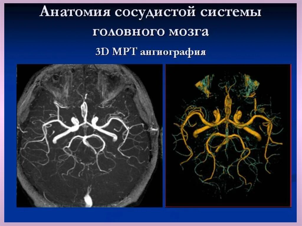 Кровообращение мозга. Виллизиев круг.. Мрт ангиография сосудов головного мозга анатомия. Кт ангиография сосудов головного мозга анатомия. Сосуды головного мозга на кт анатомия.