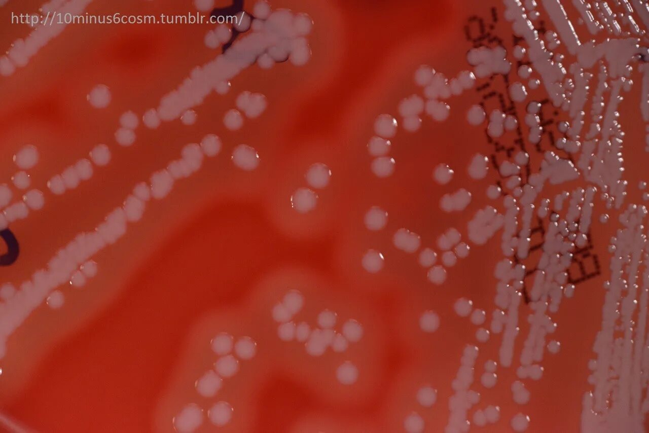 Staphylococcus pseudintermedius