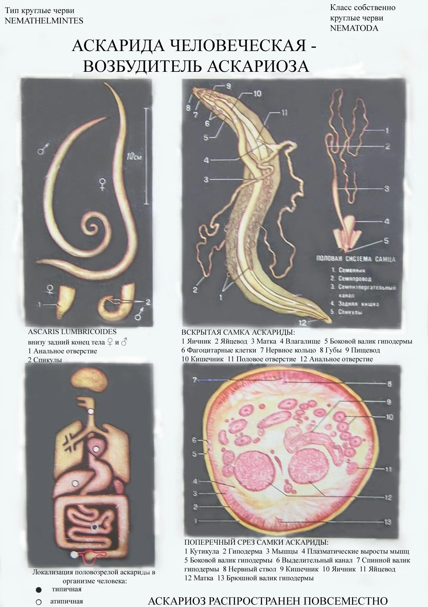 В каком органе обитает взрослая особь аскариды. Круглые черви аскарида человеческая. Тип круглые черви аскарида человеческая.