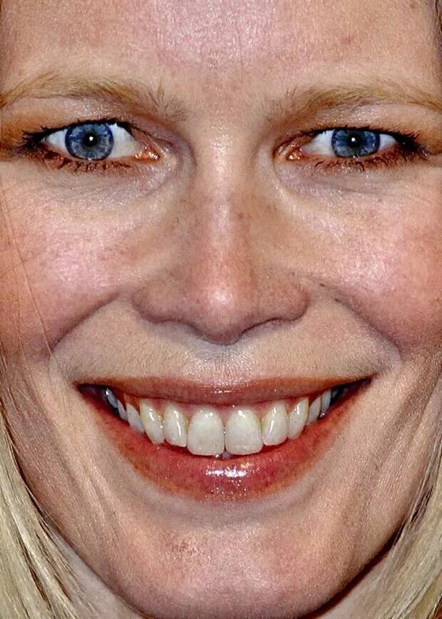 Брюс гилден. Клаудиа шиффер зубы. Некрасивое мужское лицо. Кристофер уокен гетерохромия. Некрасивое мужское лицо.