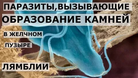 Паразиты в желчном