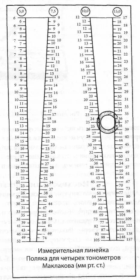 Маклаков внутриглазного давления. Тонометрия ВГД по маклакову. Измерение внутриглазного давления по маклакову норма. Линейка для измерения ВГД по маклакову. Линейка для измерения внутриглазного давления по маклакову.