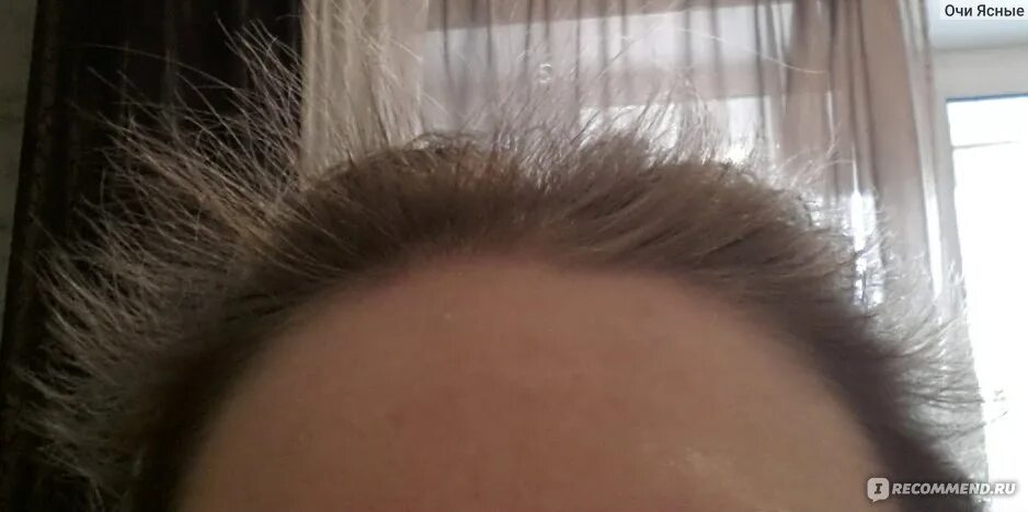 Ломаются волосы. Поврежденные волосы длинные. Пережженные волосы. Сильно обесцвеченные волосы. Волосы обломались на макушке.