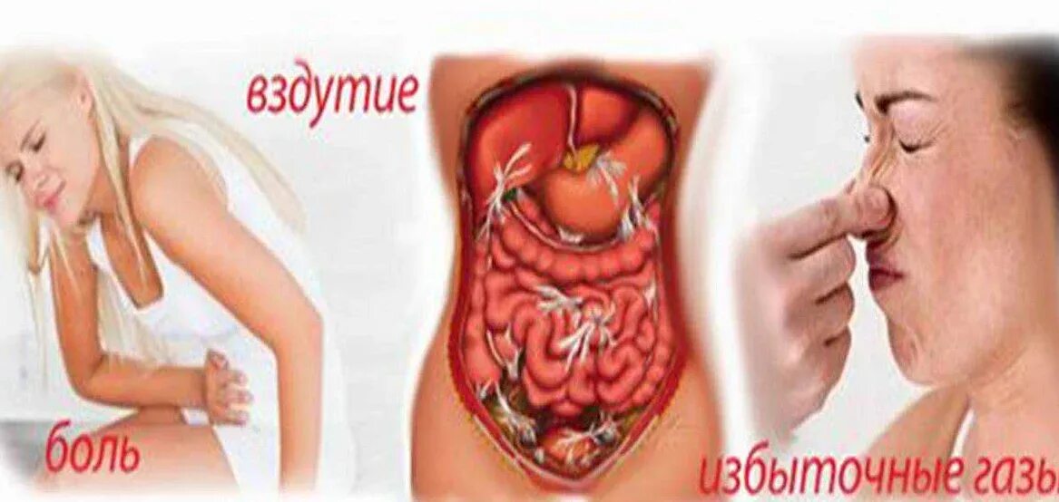 Сильный запор боли. Кишечник и вздутие живота.