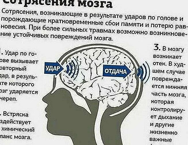 Рвота после сотрясения. Сотрясение головы симптомы. Признаки сотрясения головного мозга. Сотрясение мозга симптомы у детей. Сотрясение головного мозга у ребенка.