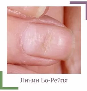 Линии бо