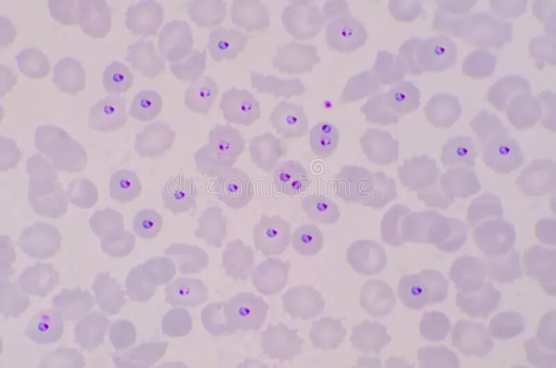 Малярия клетки. Плазмодий Вивакс. Plasmodium falciparum шизонт. Малярийный плазмодий. Plasmodium falciparum на стадии кольца.