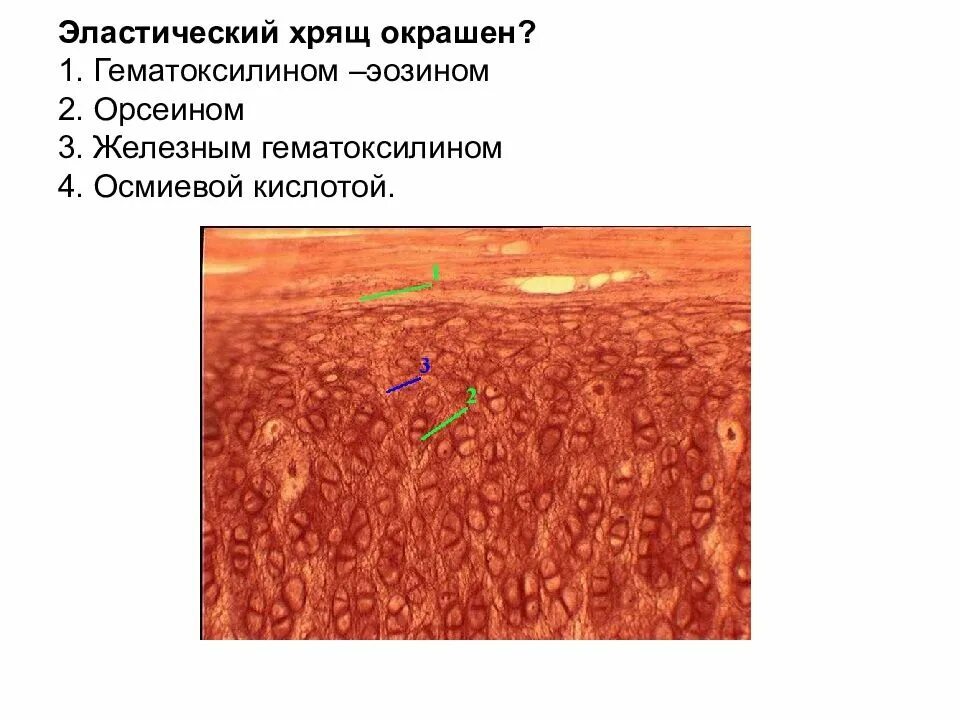 Эластическая связка. Эластический хрящ орсеин гематоксилин. эластическая хрящевая ткань окраска гематоксилин и орсеин. эластический хрящ окраска орсеин гематоксилин. эластический хрящ гистология препарат орсеин.
