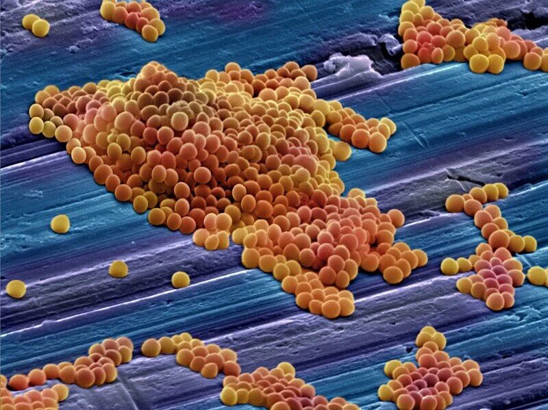Микроорганизмы стафилококки. Aureus золотистый стафилококк. Бактерия стафилококк ауреус. Микроорганизмы стафилококки. Бактерия золотой стафилококк.