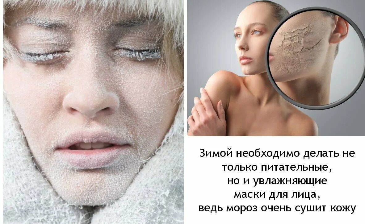 Зачем человеку зима. Кожа зимой. сухая кожа зимой. зима для сухой кожей лица. лицо на холоде.