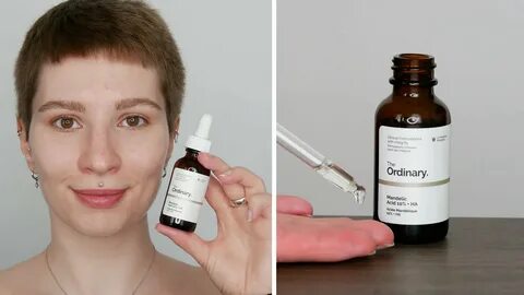 Миндальная кислота для лица
