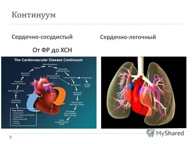 ХОБЛ И сопутствующие заболевания сердечно-сосудистой системы. Заболевания сердечно-сосудистой и легочной системы. ХОБЛ И заболевания сердечно сосудистой системы. Сердечно сосудистая система при ХОБЛ.