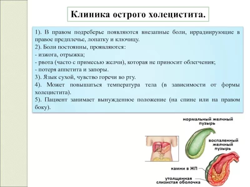 Ноющая боль в левом подреберье причины. Острый холецистит клиника. Боль в правомиподреберье. Изжога при остром холецистите. Боди вправом подреберье.