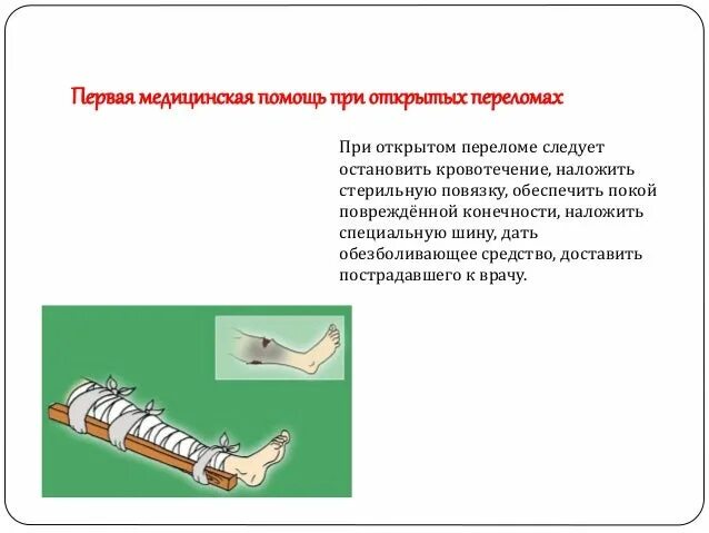 Оказание медицинской помощи при открытом переломе. Открытый перелом бедра первая помощь алгоритм действий. оказания первой медицинской помощи при открытых переломах костей. 1я помощь при закрытом переломе. порядок оказания первой помощи при открытом переломе.