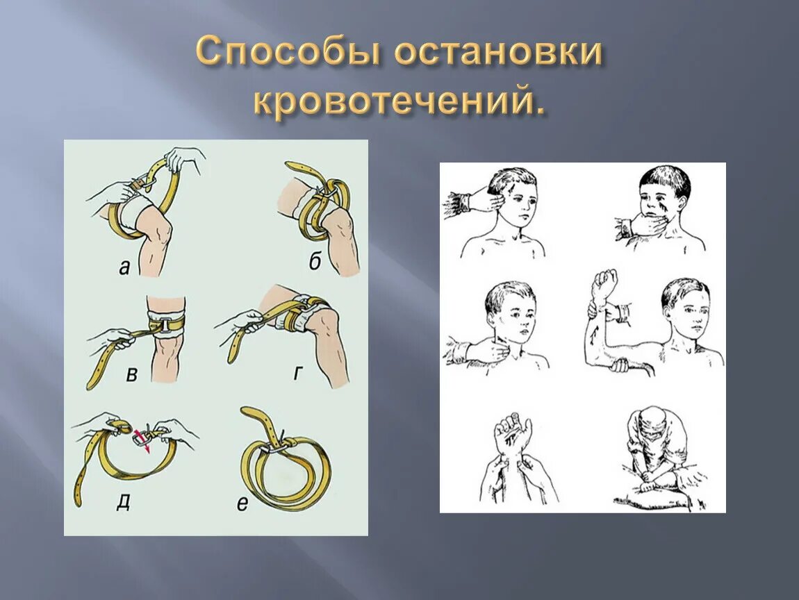 Способы остановки кровотечения. Остановка кровотечения ОБЖ. Способы остановки кровотечения рисунки. Способы остановки артериального кровотечения ОБЖ.