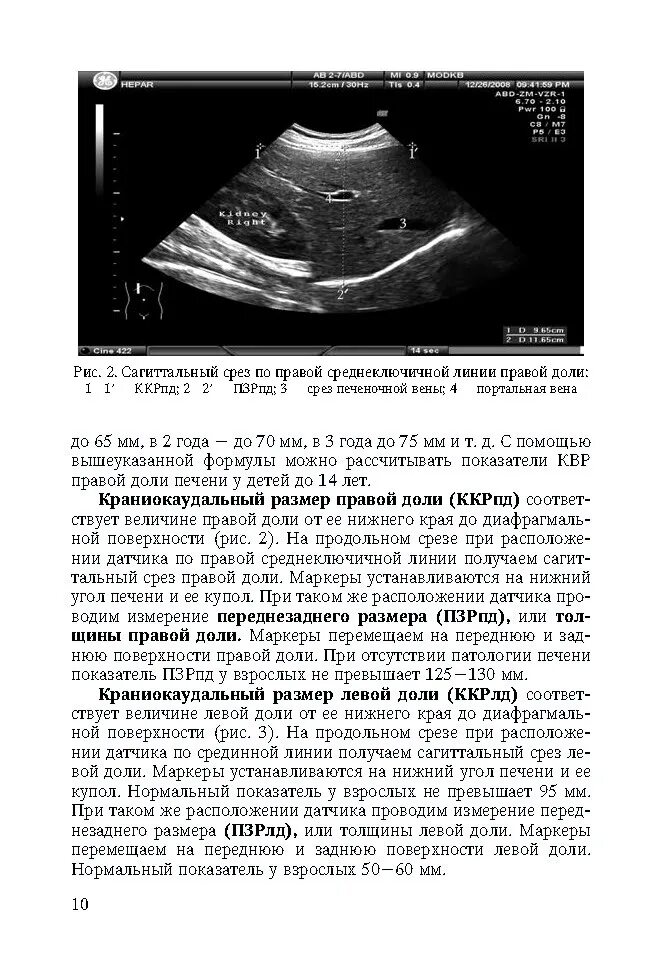 Квр печени увеличена. УЗИ печени нормальные показатели у детей. Показатели УЗИ печени норма. Толщина левой доли печени норма по УЗИ. Ультразвуковые Размеры печени в норме.