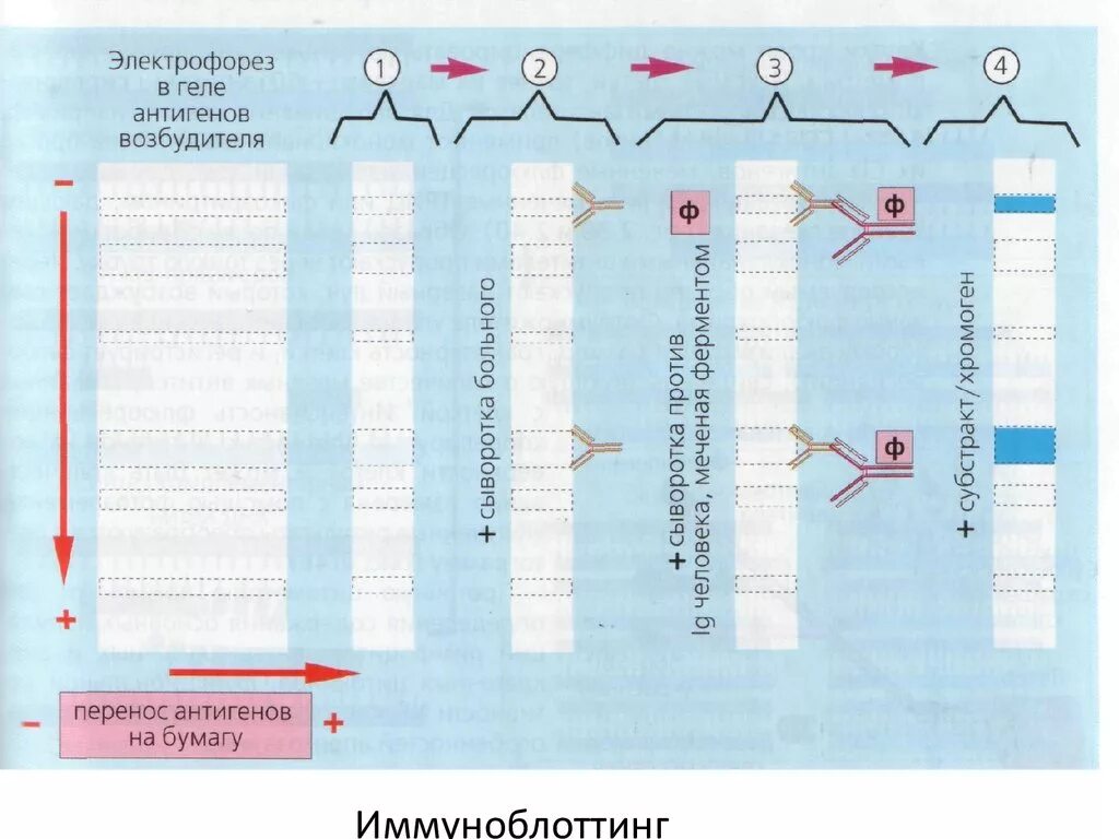 Иммуноблоттинг компоненты реакции. Иммуноблоттинг микробиология схема. Реакция иммуноблоттинга схема. Иммуноблоттинг ВИЧ микробиология.