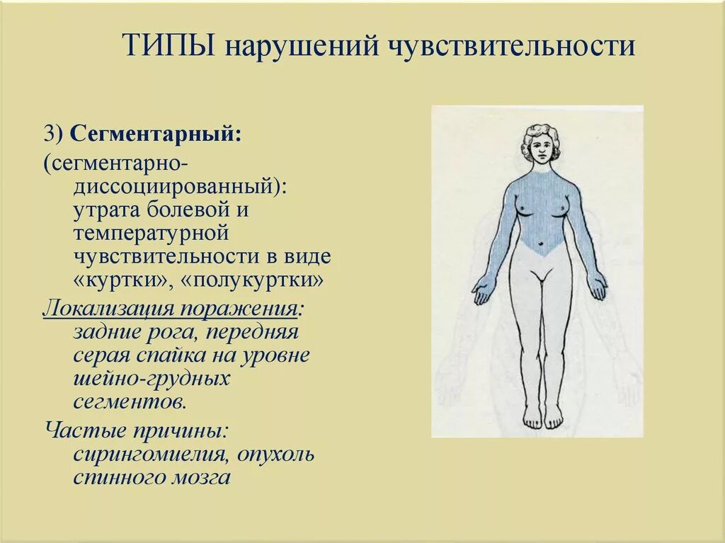 Сегментарный Тип расстройства чувствительности. Сегментарно диссоциированный Тип чувствительности. Сегментарный проводниковый Тип расстройства чувствительности. Спинально проводниковый Тип нарушения чувствительности.