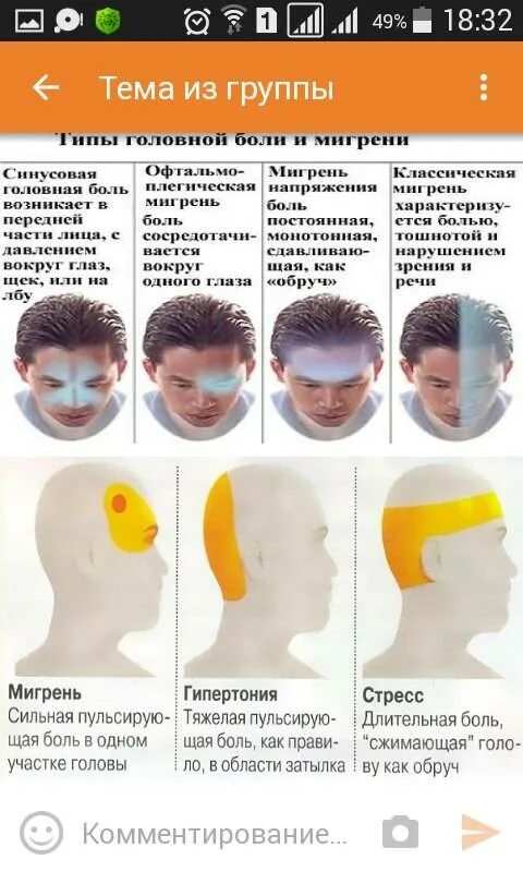 Схема локализации головной боли. Причины головной боли. Болит затылок головы.