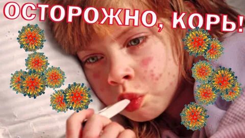 Корь новости сегодня