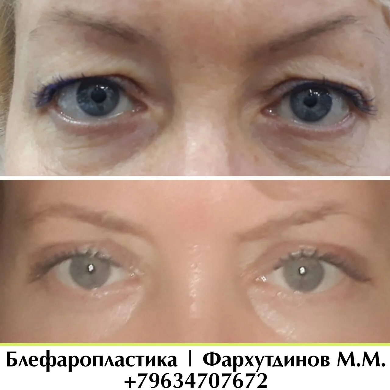 История ** 4 урок