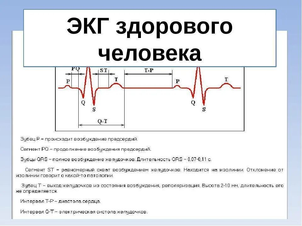 Расшифровка ЭКГ показатели нормы таблица. Отрицательный зубец р после QRS комплекса. QRST на ЭКГ норма. Расшифровка ЭКГ сердца у взрослого человека норма. В каких условиях необходимо проводить исследование экг