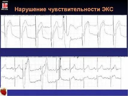 Экс каком