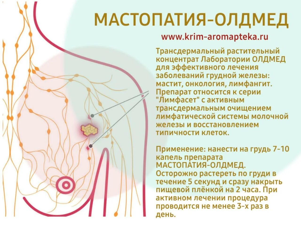 Симптомы мастопатии молочной железы у женщин