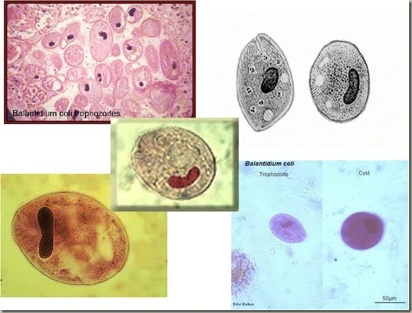 Самая первая. Ротовая амеба Entamoeba gingivalis. Entamoeba gingivalis микроскопия. Entamoeba gingivalis заболевание. Еntamoeba coli в копрограмме. Entamoeba coli в кале