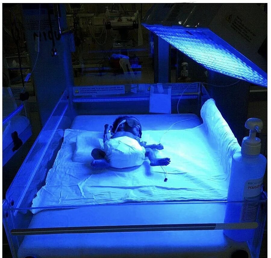 Лампа для желтушка у новорожденных. Лампа для фототерапии "Phototherapy 4000. Ультрафиолетовая лампа при желтухе новорожденных. УФ лампа от желтушки для новорожденного.