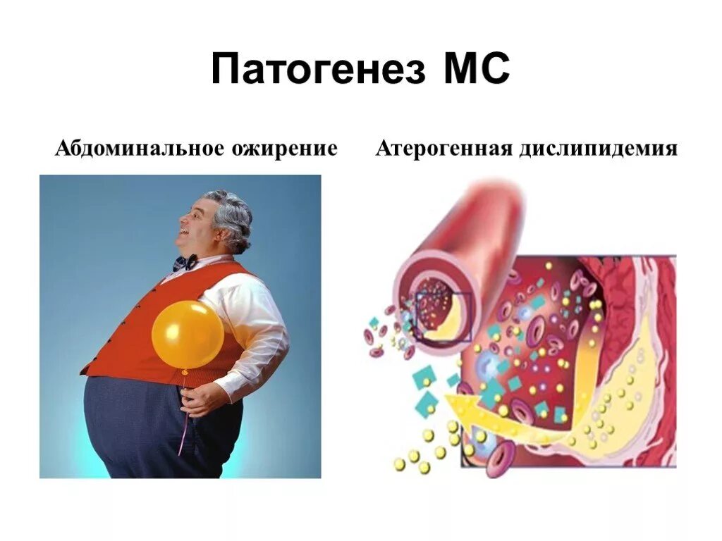 Генез ожирения