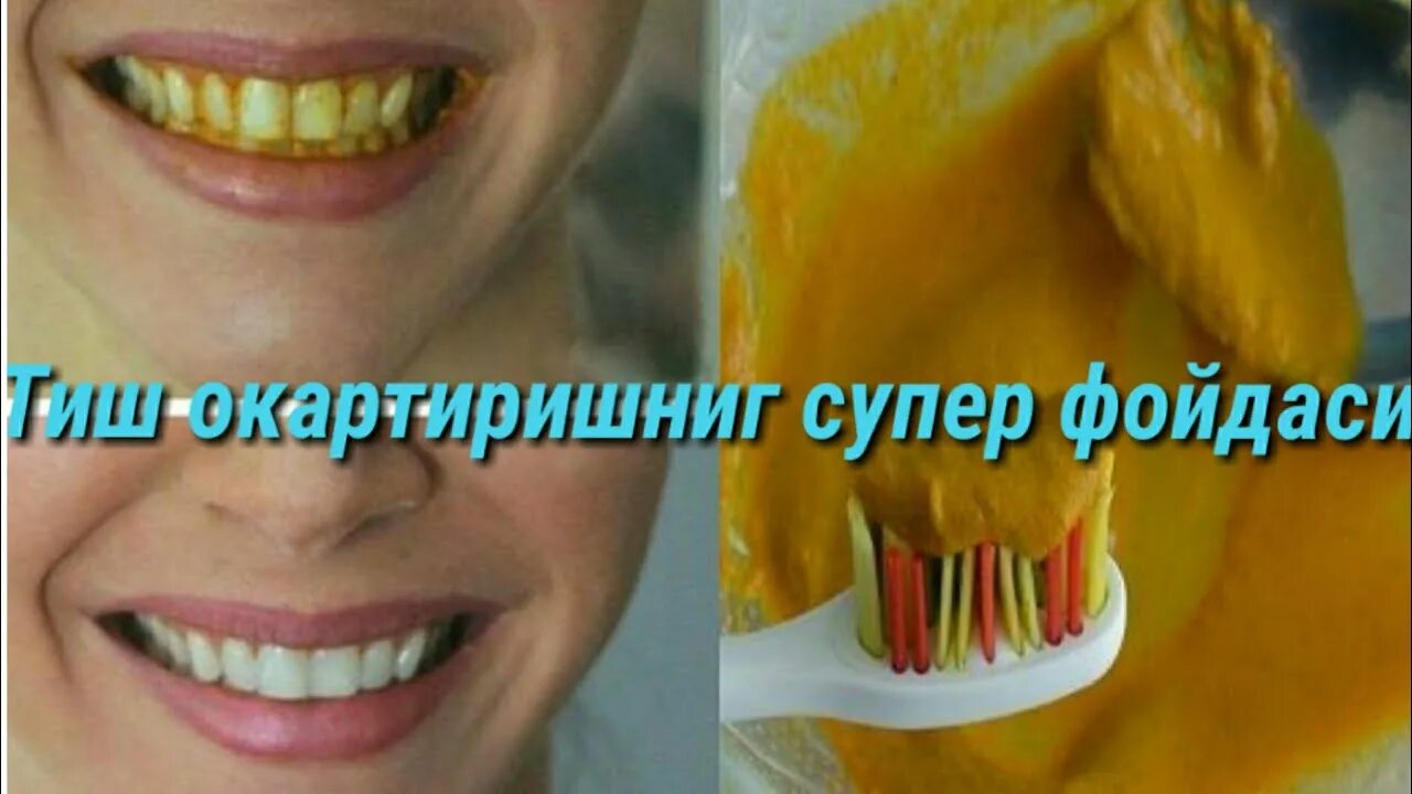 Зубы желтый чистить. Отбеливание желтых зубов.