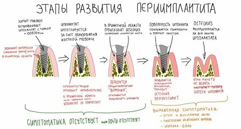 Воспались импланты