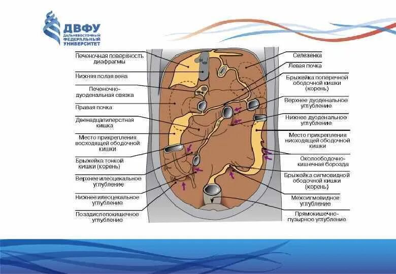 Карманы и сумки брюшной полости топографическая анатомия. Межсигмовидное углубление. Карманы нижнего этажа брюшной полости топографическая анатомия. Межсигмовидное углубление. Межсигмовидное углубление.