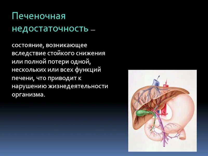 Печень недостаточно. Печеночнаямнедостаточность. печеночная недостаточность. недостаточность функции печени. печеночная недостаточность патология.