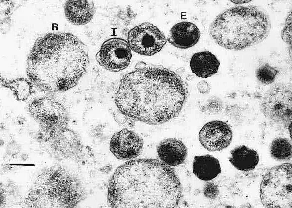 Chlamydia trachomatis. Хламидия пневмония под микроскопом. Хламидии пневмония микроскопия. Chlamydia trachomatis микроскопия. Хламидии в инфицированных клетках.