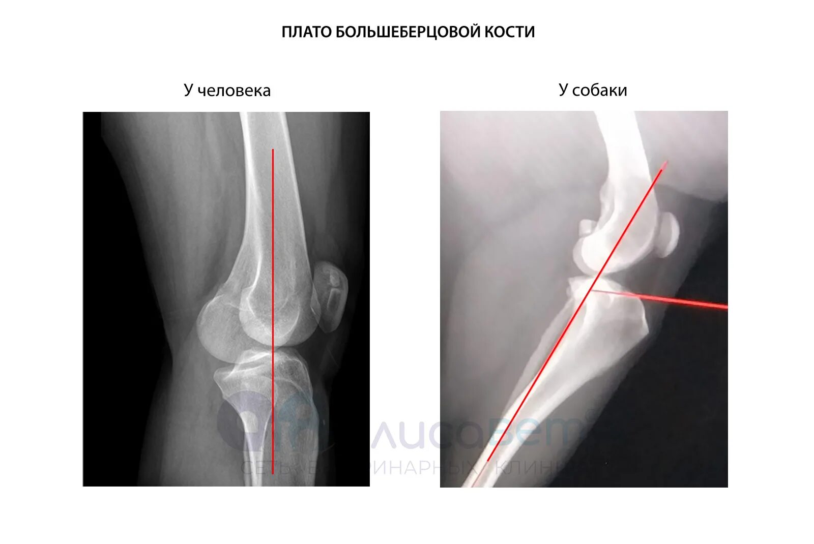 Разрыв связки у собаки. Отрыв бугристости большеберцовой кости у собак. Угол плато большеберцовой кости у собак. Разрыв крестовидной связки у собак. Отрыв шероховатости большеберцовой кости у щенка.