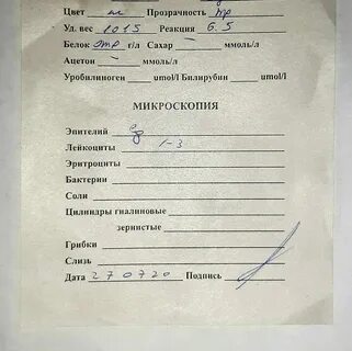 Анализ мочи 20 мл хватит - 44 фото из 48