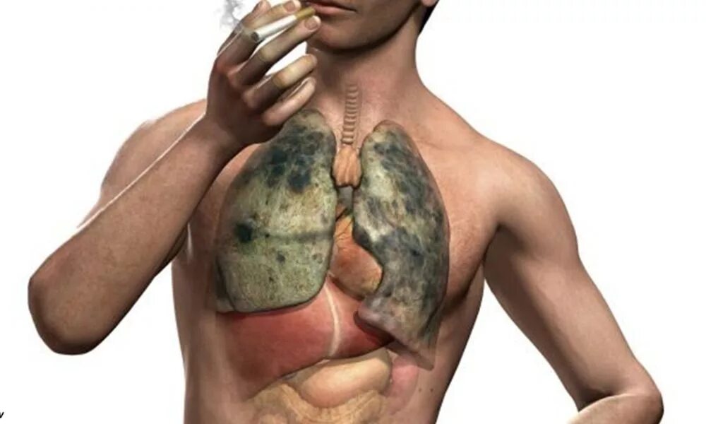 Здоровый и больной человек. Здоровый и больной человек. Как выглядит здоровый человек и больной. Здоровый и не здоровый человек. Здоровый и больной человек.