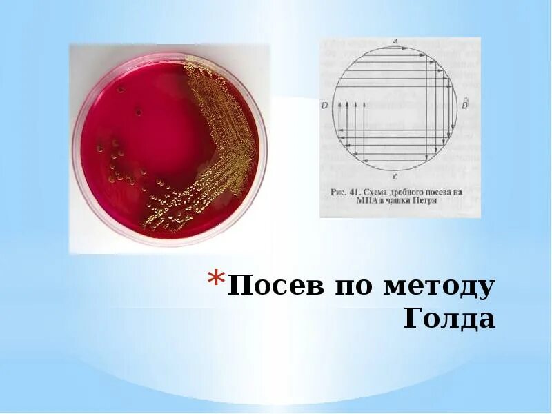 Интерпретация посева. Посев по голду микробиология методика. метод голда микробиология посев. метод секторных посевов по голду. схема посева мочи.