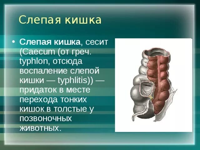 Слепая кишка развитие. Слепая кишка с аппендицитом. Воспаление слепой кишки. Слепая кишка воспаление.