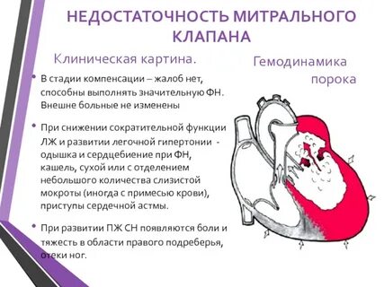 Митральные пороки сердца